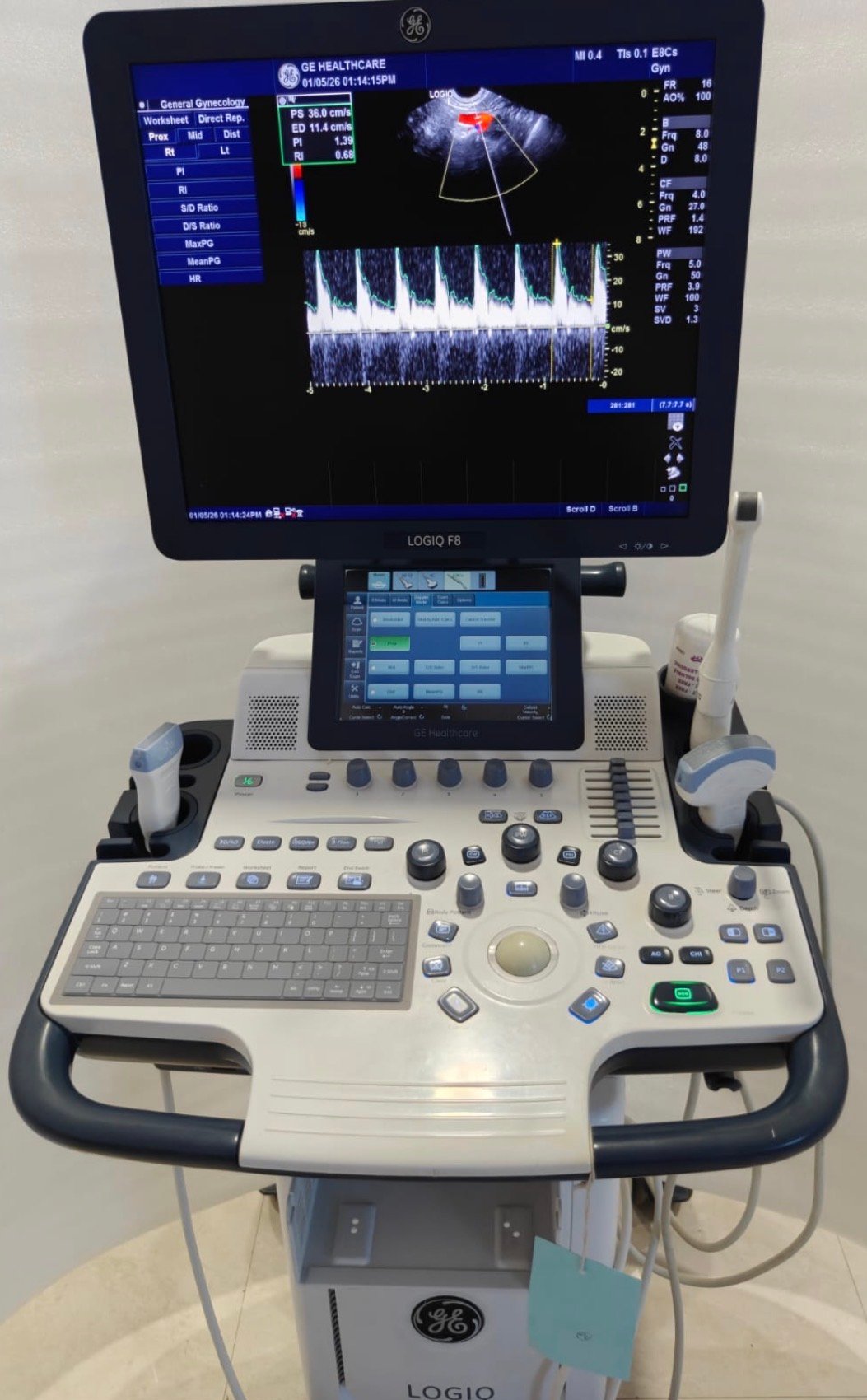 Excellent GE Healthcare Logiq F8 (2015) image 5