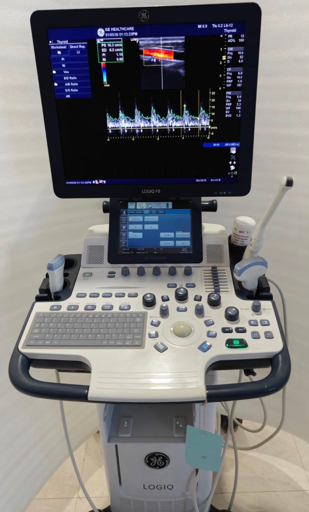 Excellent GE Healthcare Logiq F8 (2015) image 6