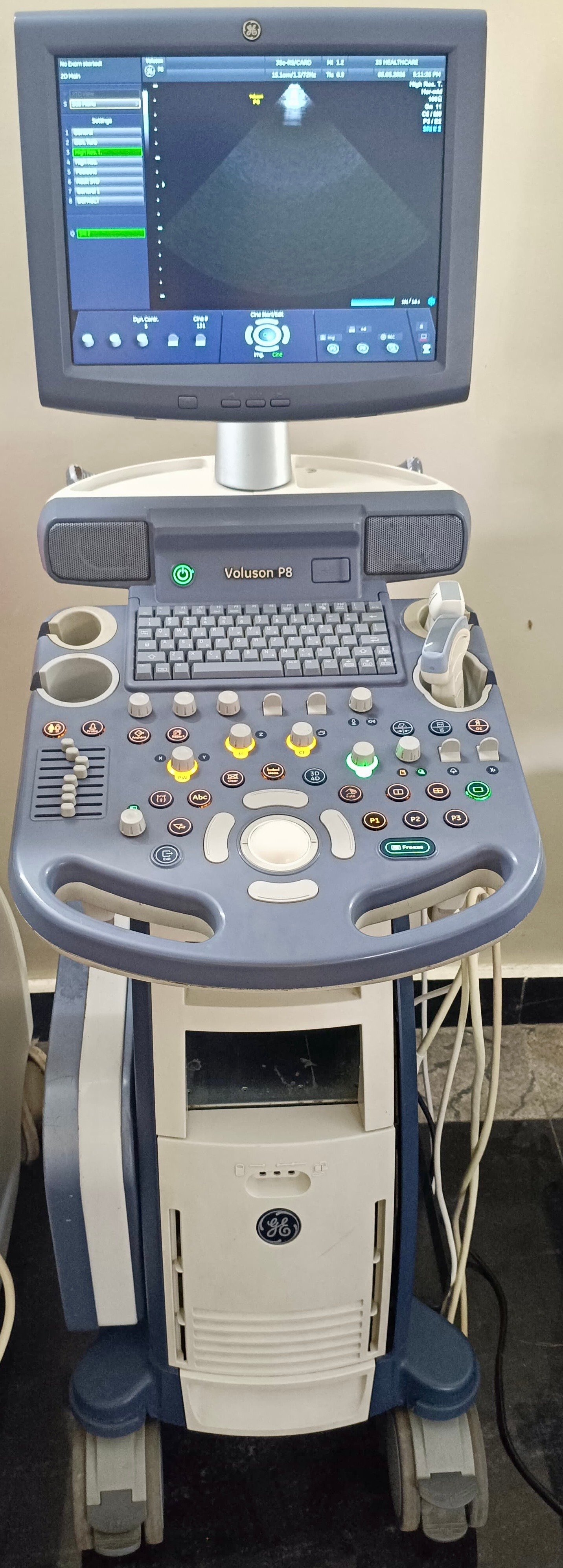 Good Condition GE Healthcare Voluson P8 (2014)
