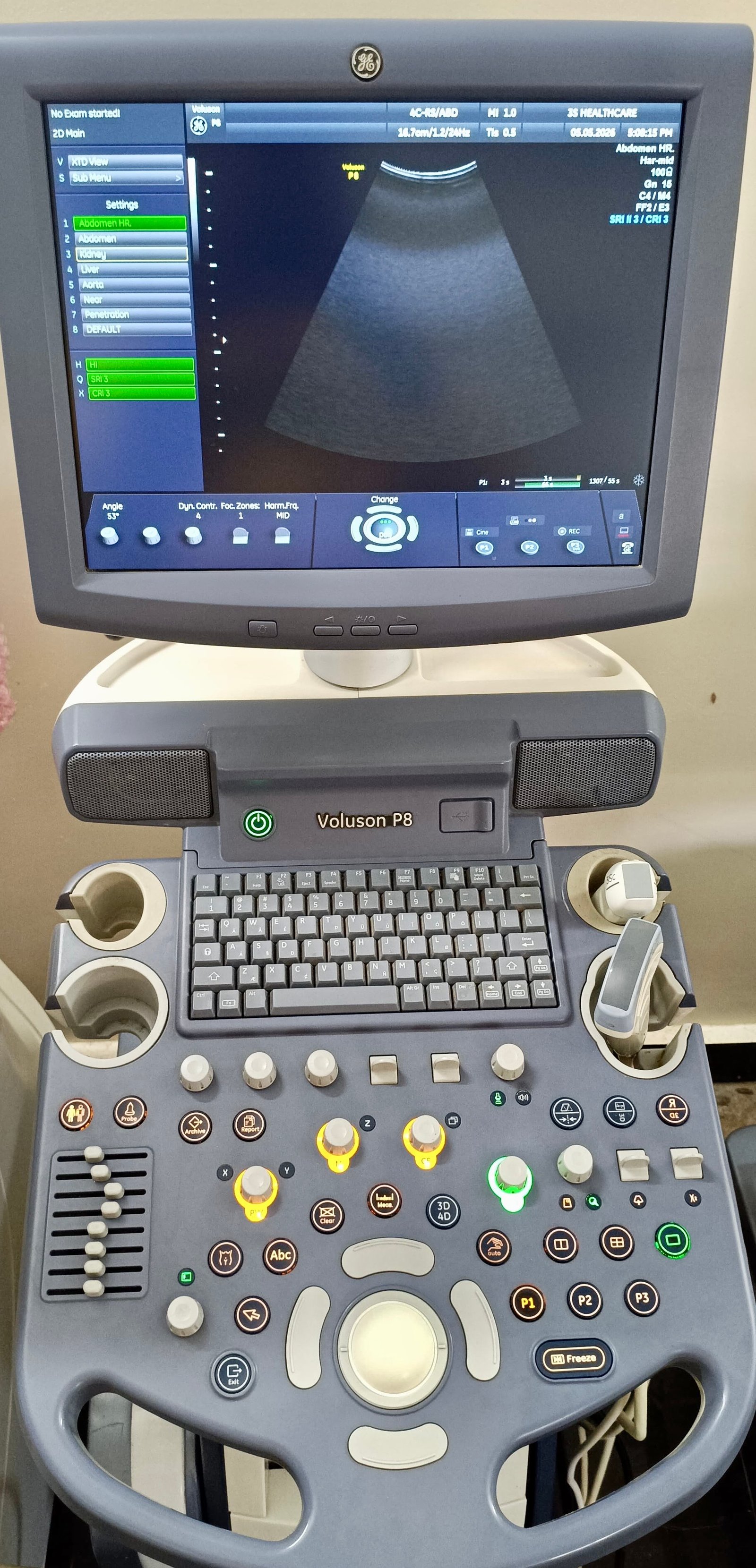 Good Condition GE Healthcare Voluson P8 (2014) image 5
