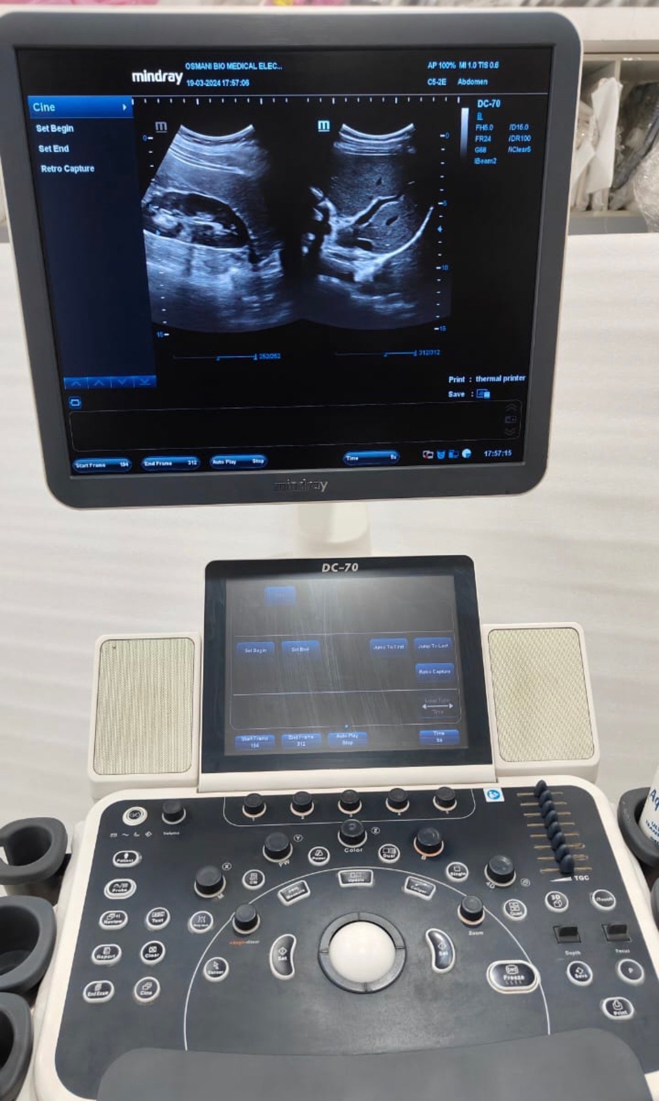 Excellent Mindray DC-70X (2019) image 2