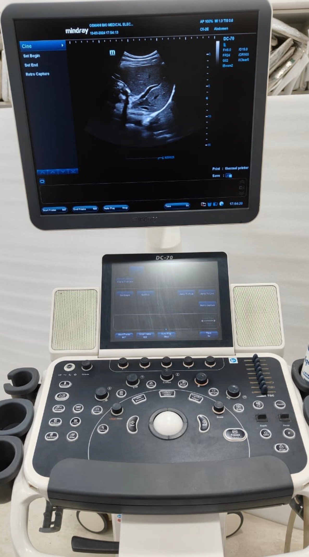 Excellent Mindray DC-70X (2019) image 3