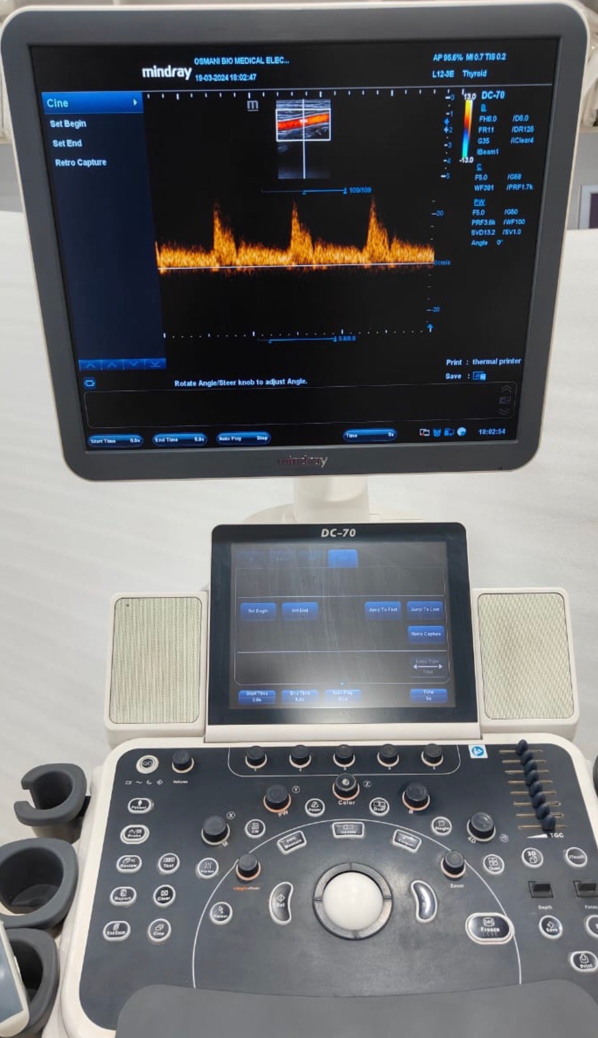 Excellent Mindray DC-70X (2019) image 5