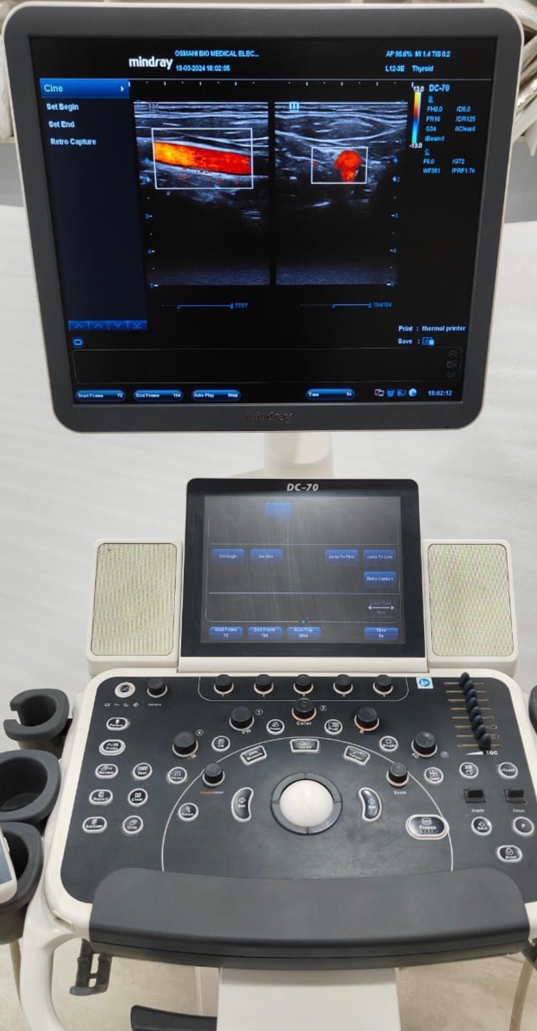 Excellent Mindray DC-70X (2019) image 6