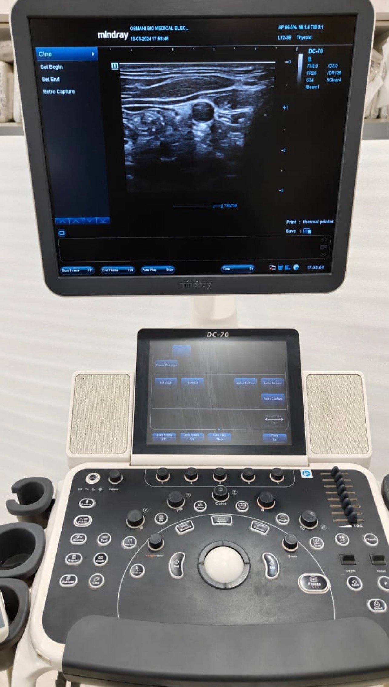 Excellent Mindray DC-70X (2019) image 8