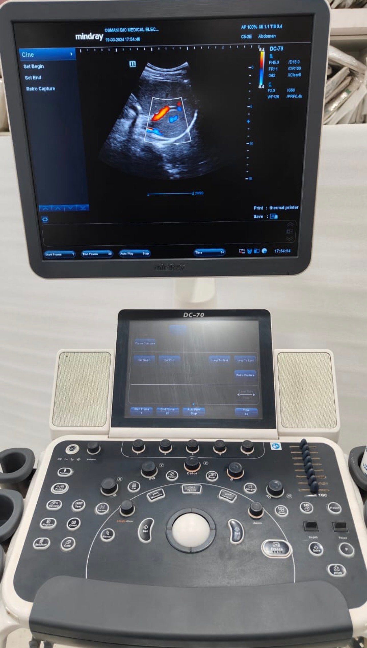 Excellent Mindray DC-70X (2019) image 9