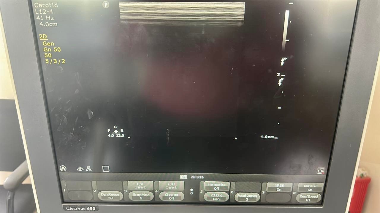 Excellent Philips ClearVue 650 (2019) image 10