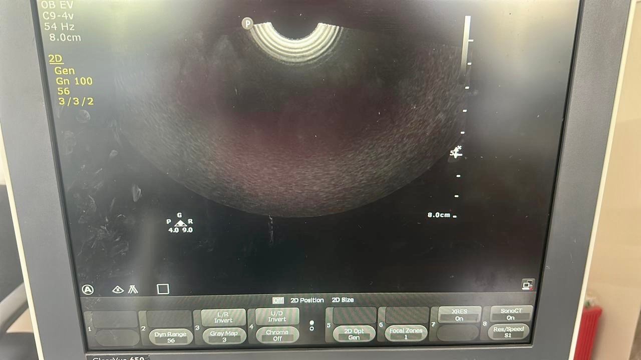 Excellent Philips ClearVue 650 (2019) image 5