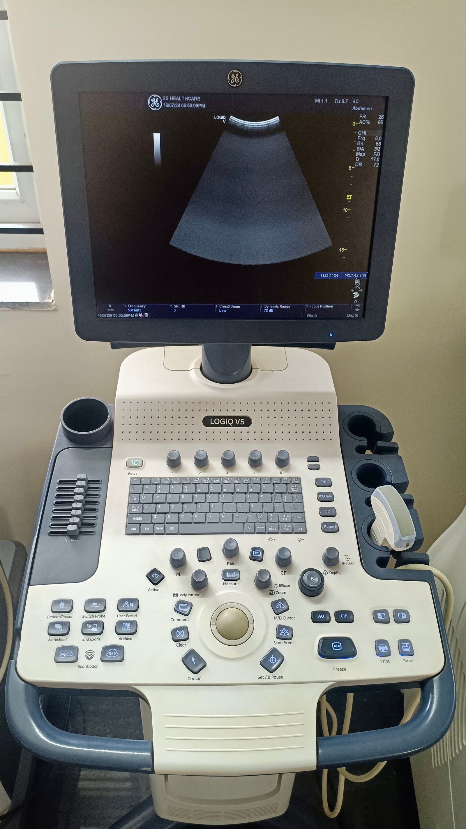 Excellent GE Healthcare Logiq V5 (2017)