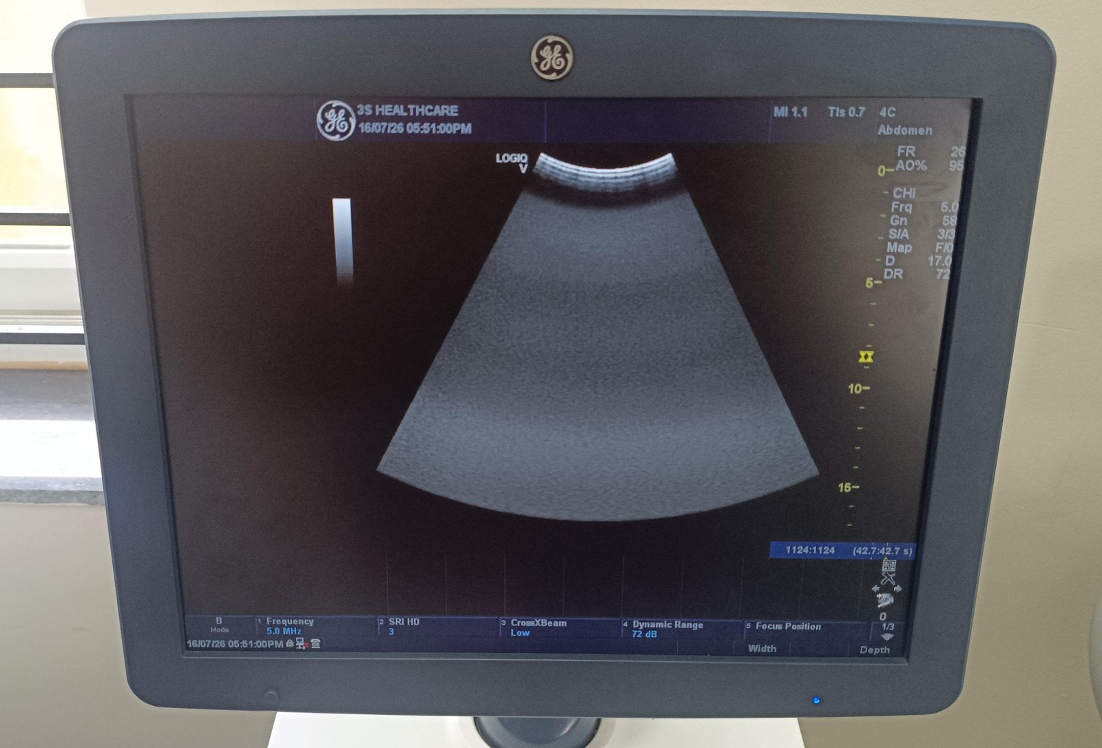 Excellent GE Healthcare Logiq V5 (2017) image 3