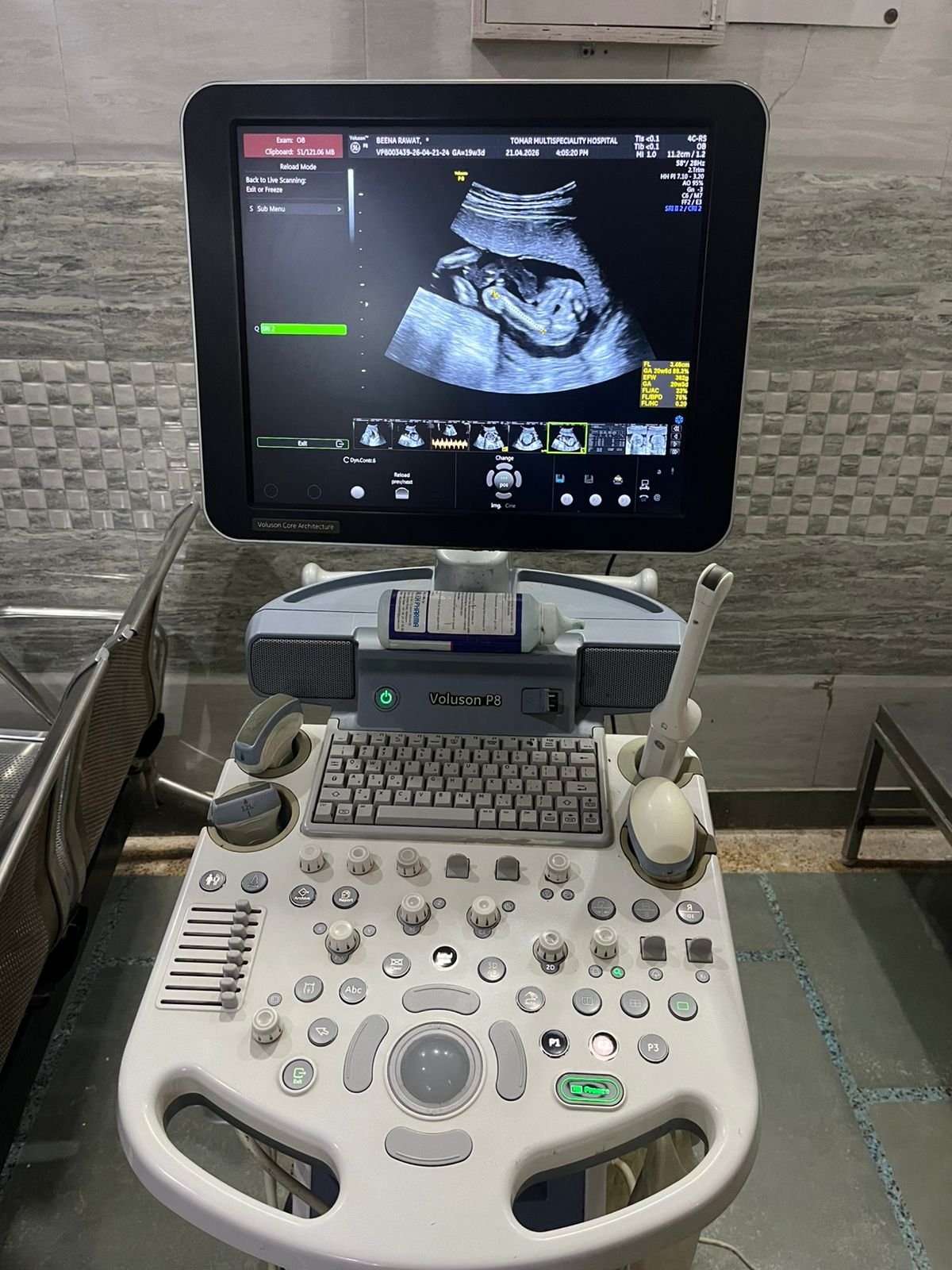 Good Condition GE Healthcare Voluson P8 (2017)