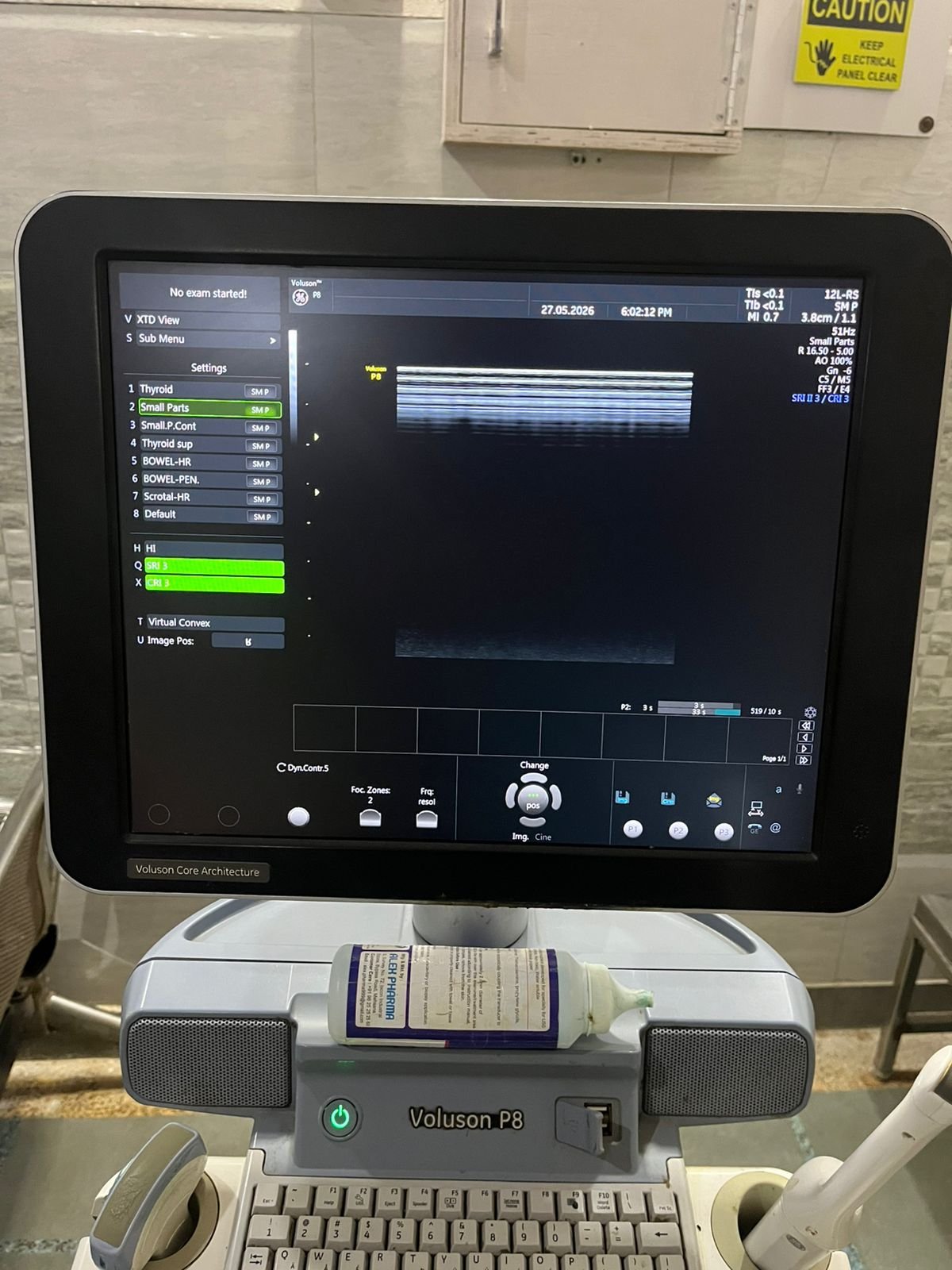 Good Condition GE Healthcare Voluson P8 (2017) image 3