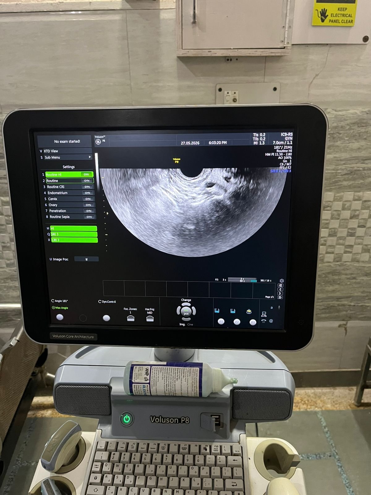 Good Condition GE Healthcare Voluson P8 (2017) image 7