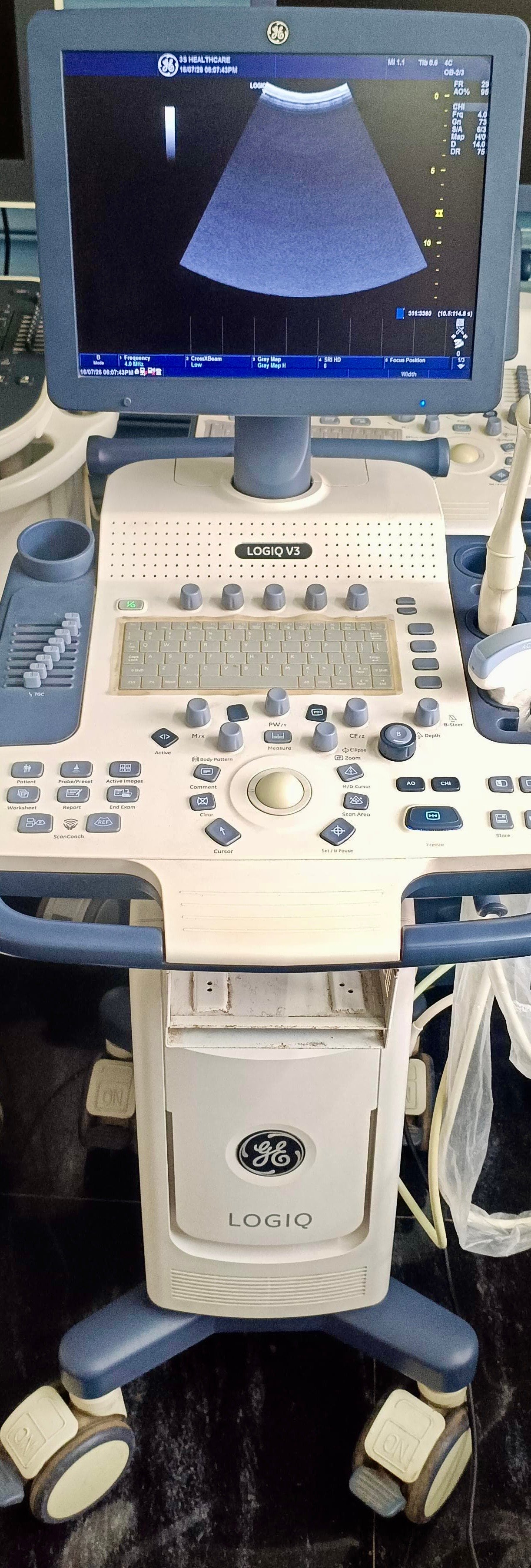 Excellent GE Healthcare Logiq V5 (2015)