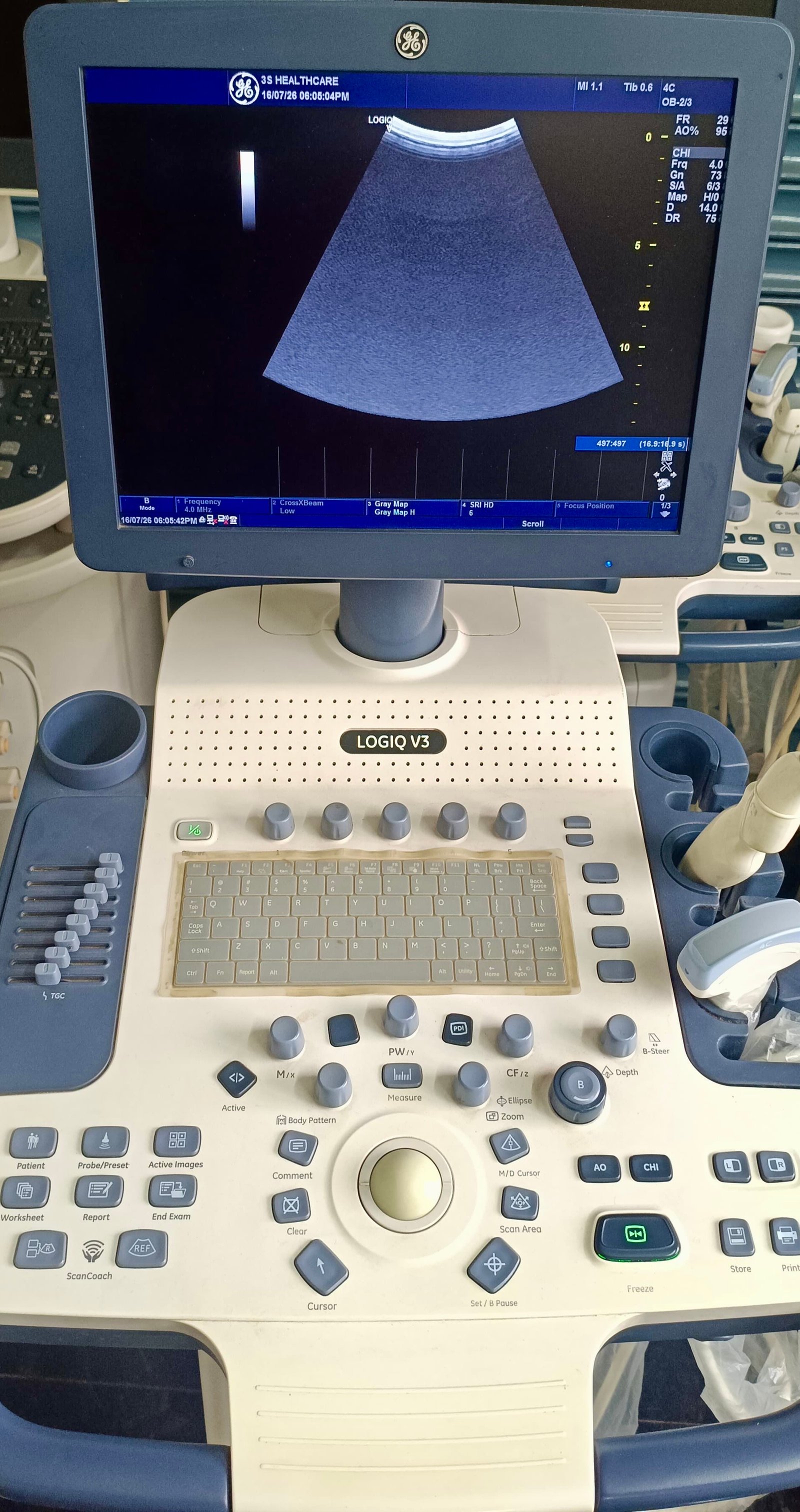 Excellent GE Healthcare Logiq V5 (2015) image 3
