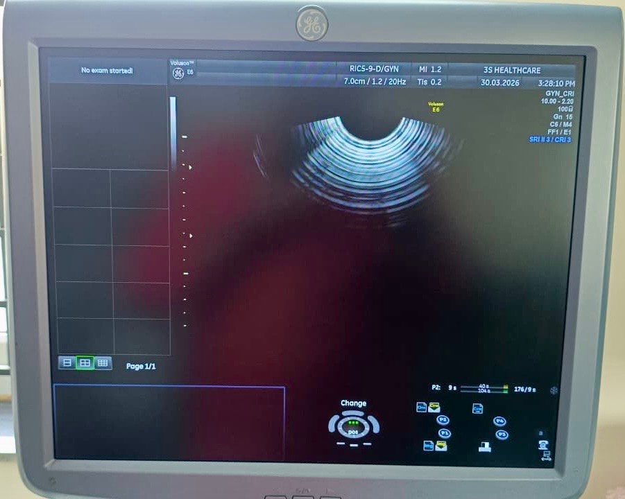 Good Condition GE Healthcare Voluson E6 (2016) image 4