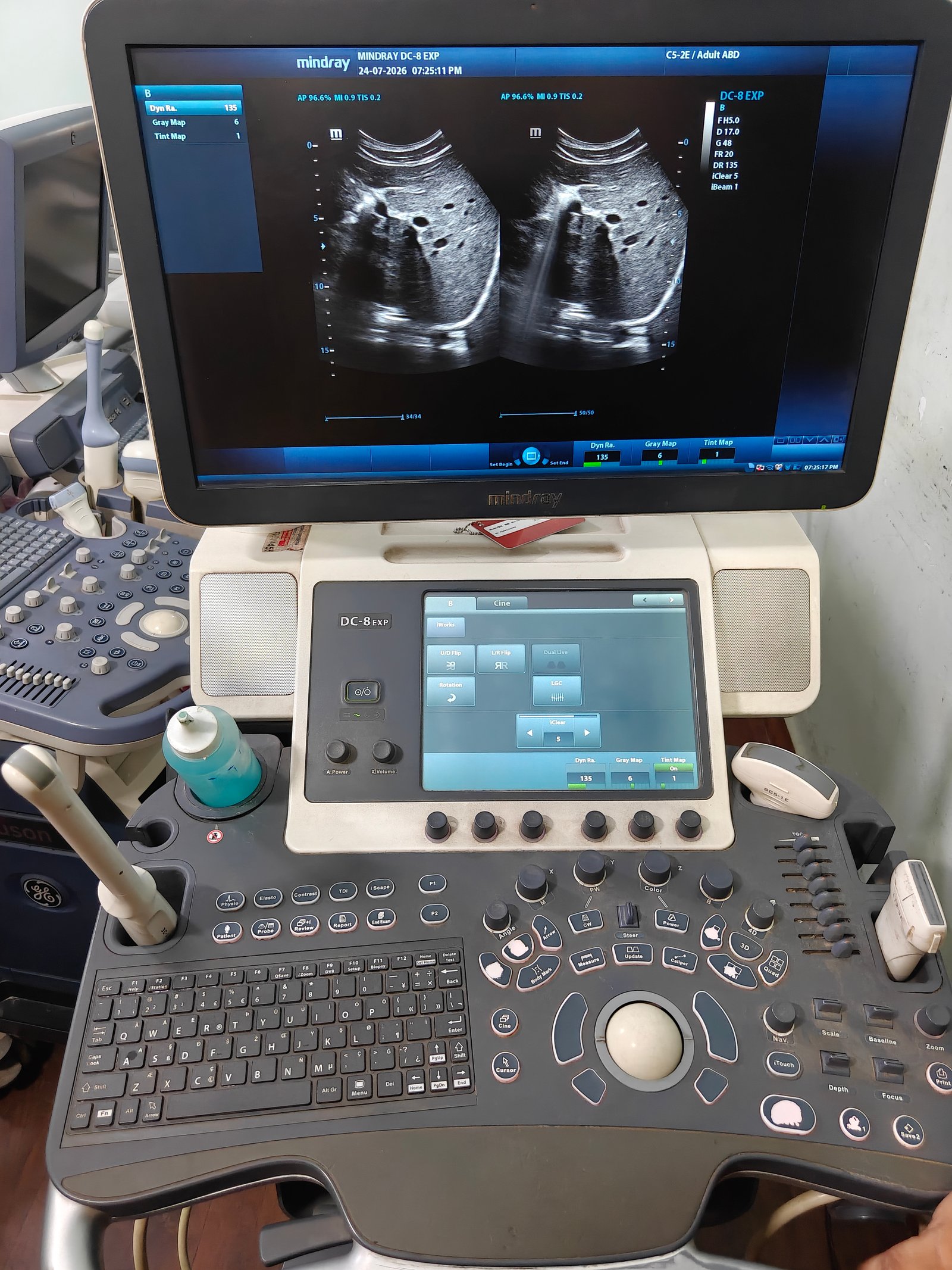 Good Condition Mindray DC8 (2018) image 1