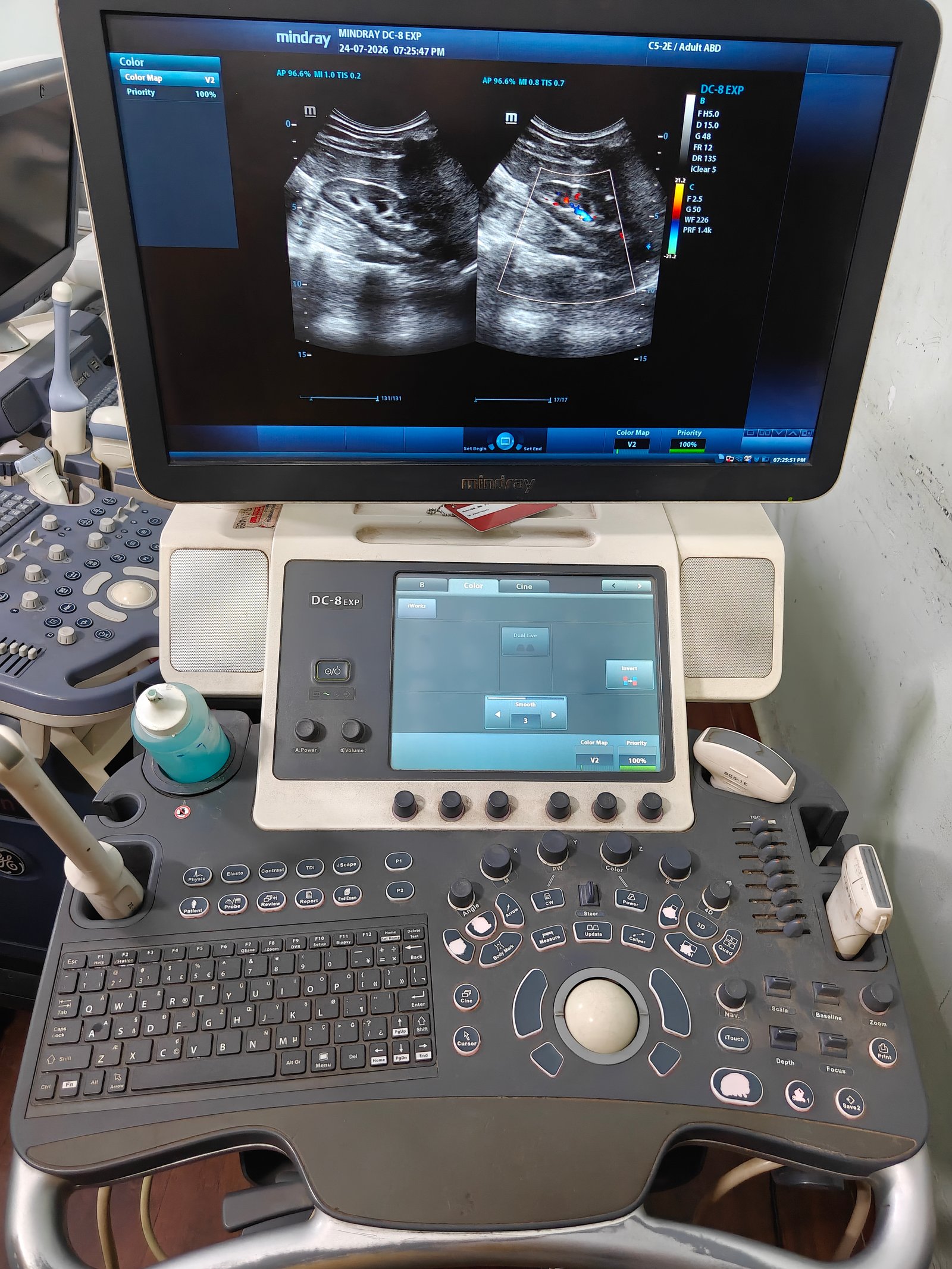 Good Condition Mindray DC8 (2018) image 6