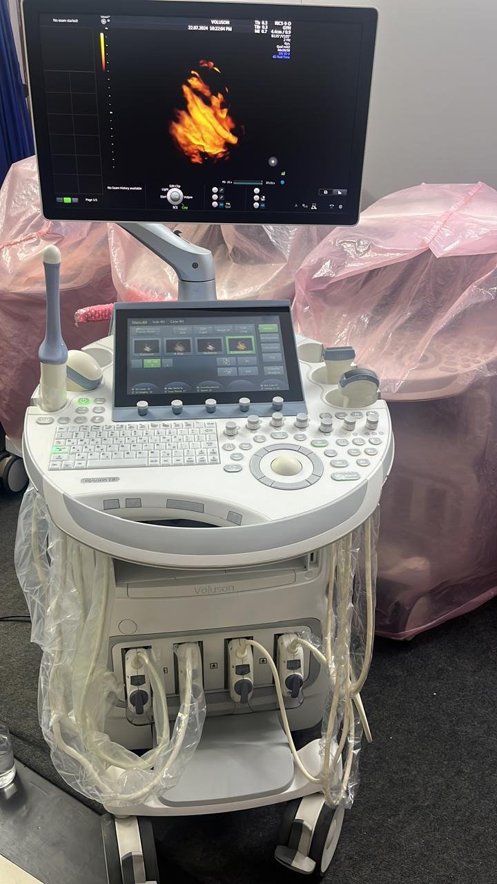 Excellent GE Healthcare Voluson E8 (2024)