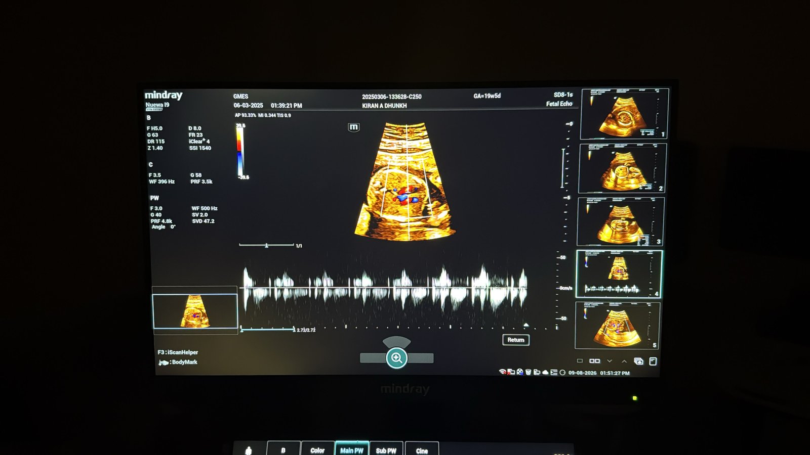 Brand New Mindray NEUWA I9 (2024) image 6