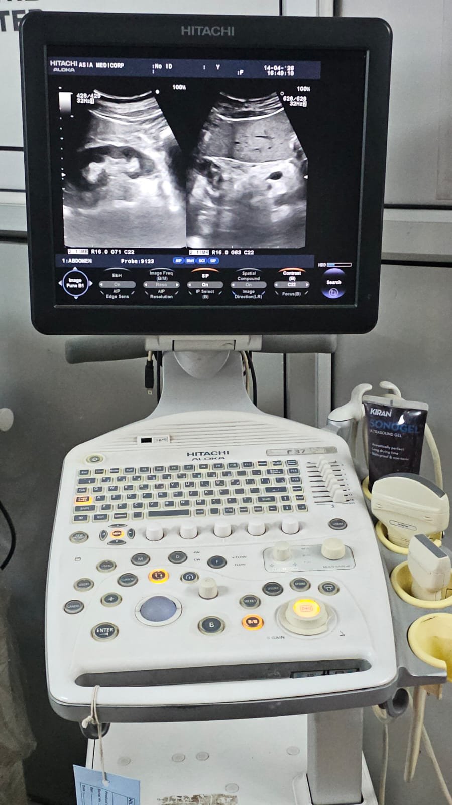 Excellent HITACHI ALOKA PROSOUND F37 (2019) image 1