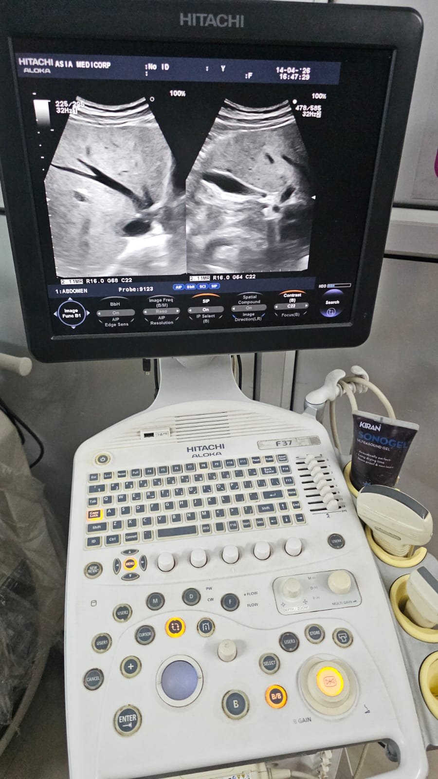 Excellent HITACHI ALOKA PROSOUND F37 (2019) image 2