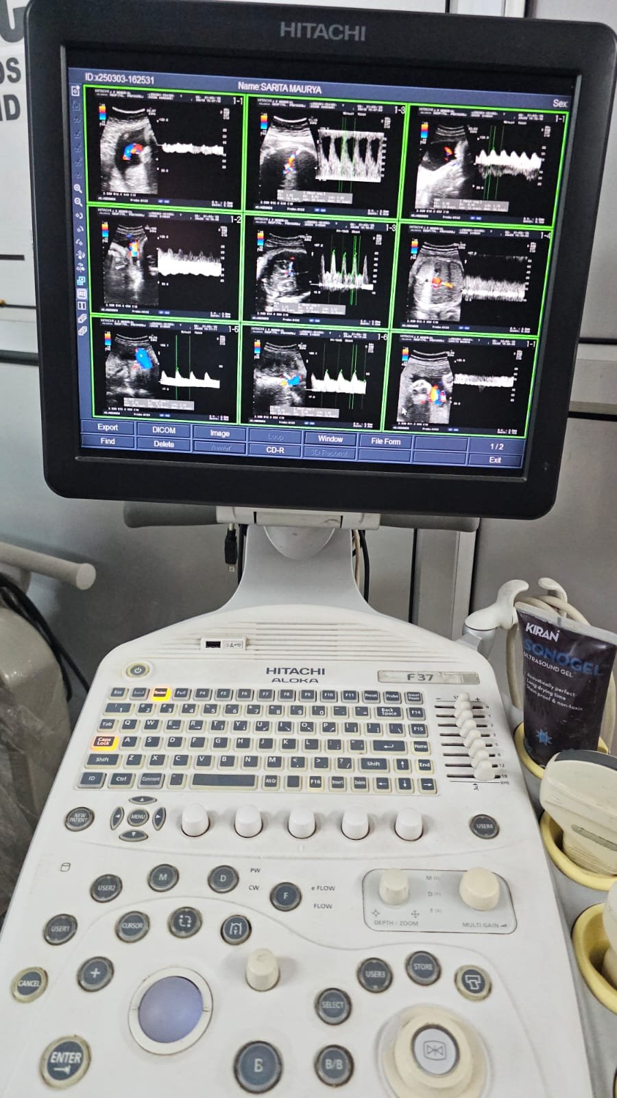 Excellent HITACHI ALOKA PROSOUND F37 (2019) image 3